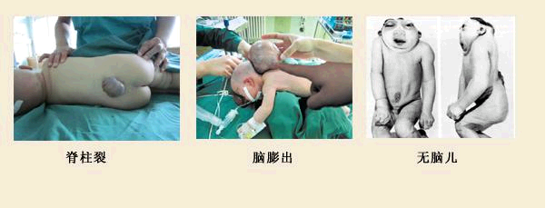 QQ截图20150116150600.png QQ截图20150116150600.png