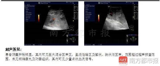 t01932b4aa23ccb1d58.jpg t01932b4aa23ccb1d58.jpg