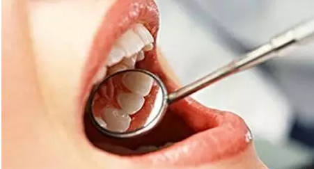 QQ截图20170412104721.png QQ截图20170412104721.png