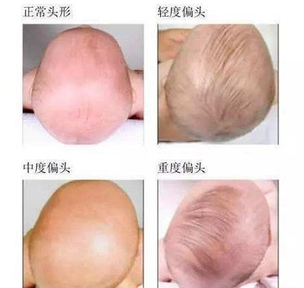 QQ截图20170417152142.png QQ截图20170417152142.png