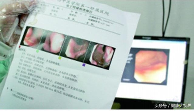 QQ截图20170420110535.png QQ截图20170420110535.png