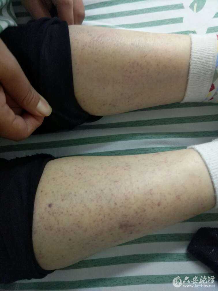 20171019_263758_1508417722173.jpg 20171019_263758_1508417722173.jpg