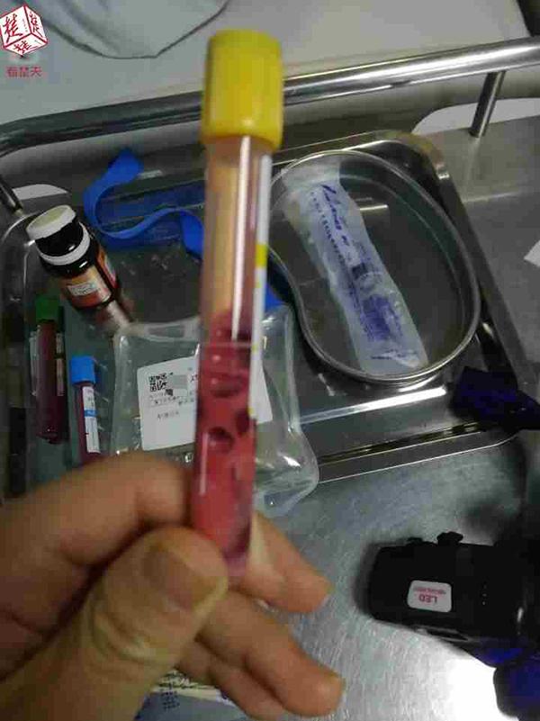 20181128024043464.jpg 20181128024043464.jpg