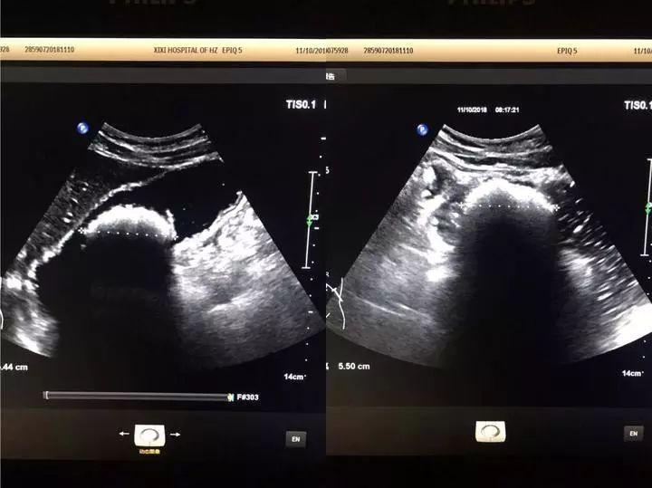 20181211043411290.jpg 20181211043411290.jpg