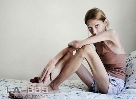 法国触目惊心反厌食症广告女主角