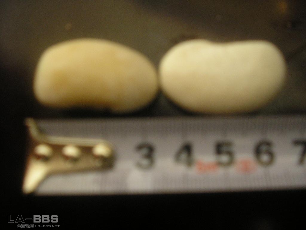 每个豆足足有3.5cm