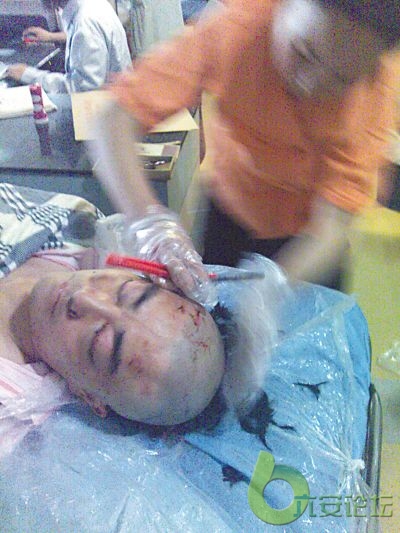 付波在抢救室的照片.jpg